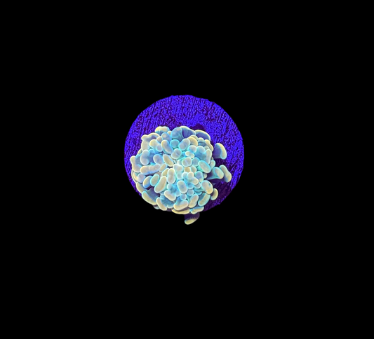 WYSIWYG Gold Branching Hammer Coral – Live LPS Euphyllia for Reef Tank